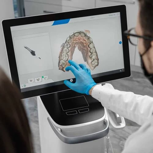 3D Intraoral Digital Optical Scanner