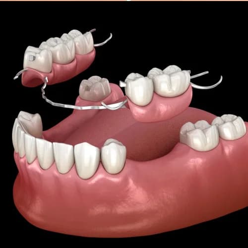 Full & Partial Custom Dentures