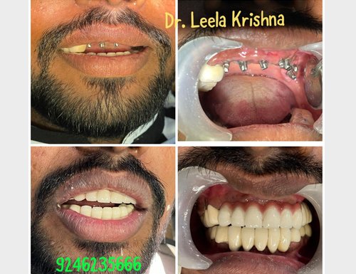 Krishna Sai Dental