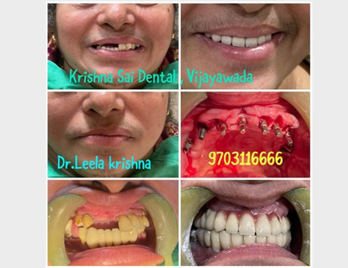 Krishna Sai Dental